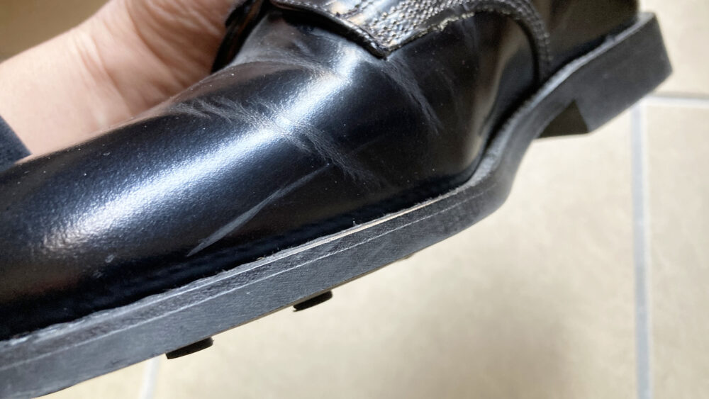 つま先横の傷ビフォー